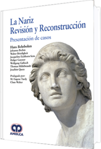 La Nariz Revisión y Reconstrucción. Presentación de Casos