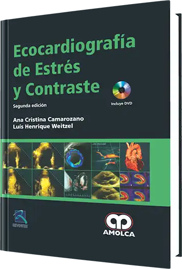 Ecocardiografía de Estrés y Contraste 2 edición