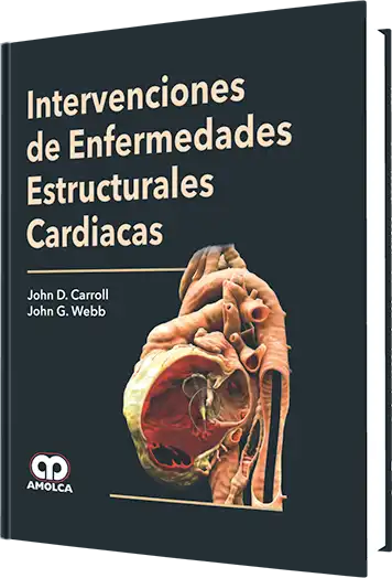 Intervenciones de Enfermedades Estructurales Cardiacas