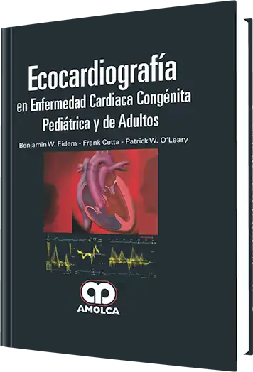 Ecocardiografía en Enfermedad Cardíaca Congénita Pediátrica y de Adultos