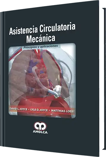 Asistencia Circulatoria Mecánica
