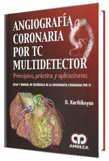Angiografía Coronaria por TC Multidetector