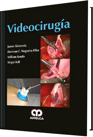 Videocirugía