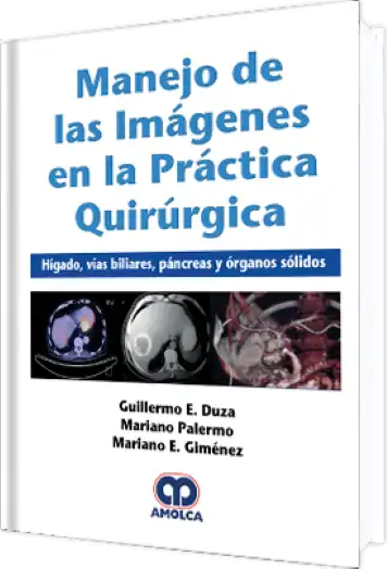Manejo de las Imágenes en la Práctica Quirúrgica / Hígado, Vías Biliares, Páncreas y Órganos Sólidos