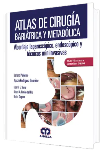 Atlas de Cirugía Bariátrica y Metabólica