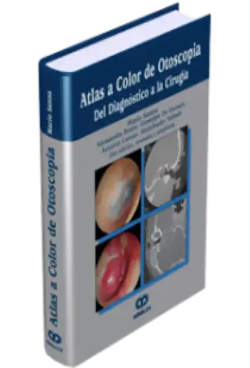 Atlas a Color de Otoscopia. 2 edición