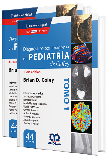 Diagnóstico por Imágenes en Pediatría de Caffey. 13 Edición