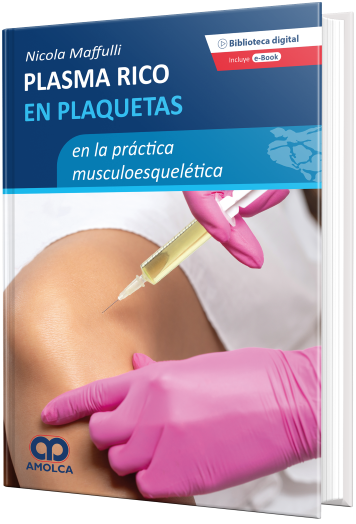 Plasma Rico en Plaquetas en la Práctica musculoesquelética
