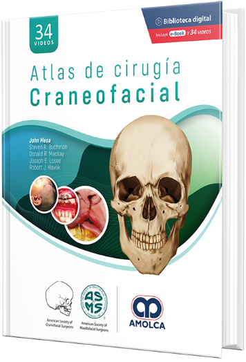Atlas de Cirugía Craneofacial