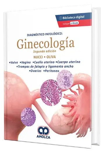 Diagnóstico Patológico: Ginecología. 2 edición
