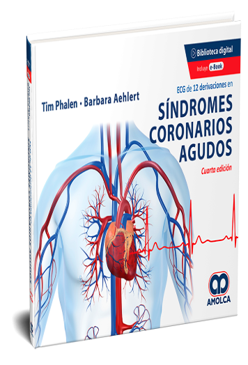 ECG de 12 Derivaciones en Síndromes Coronarios Agudos. 4 Edición