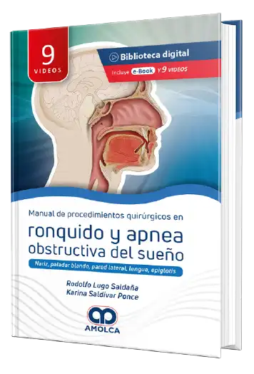 Manual de Procedimiento quirúrgicos en Ronquido y Apnea obstructiva del sueño