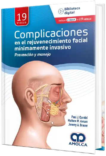 Complicaciones en el rejuvenecimiento facial mínimamente invasivo  - Prevencion y manejo
