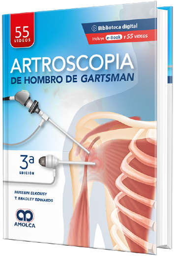 Artroscopia de Hombro de Gartsman