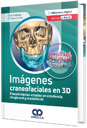 Imágenes Craneofaciales en 3D