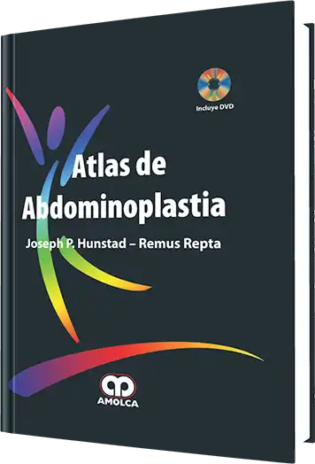Atlas de Abdominoplastia