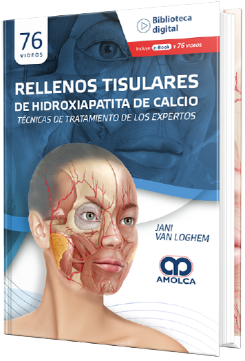 Rellenos Tisulares de Hidroxiapatita de Calcio. Técnicas de tratamiento de los expertos