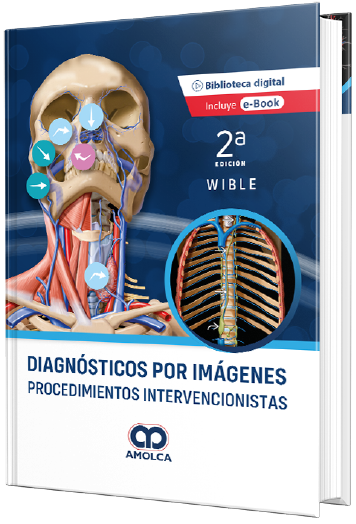 Diagnósticos por imágenes - Procedimientos Intervencionistas. 2a Edición