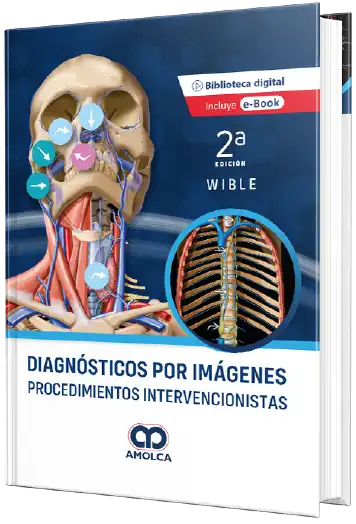 Diagnósticos por imágenes - Procedimientos Intervencionistas. 2a Edición