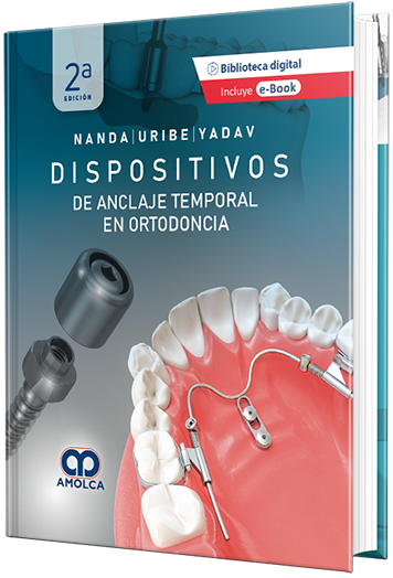 Dispositivos de anclaje temporal en ortodoncia 2a. Edición