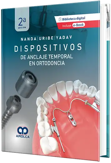 Dispositivos de anclaje temporal en ortodoncia 2da. Edición