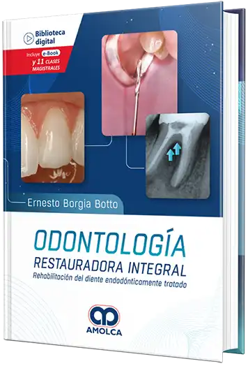 Odontología restauradora integral