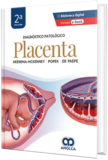 Diagnóstico patológico Placenta - 2a Edición