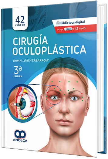 Cirugía Oculoplástica 3a Edición
