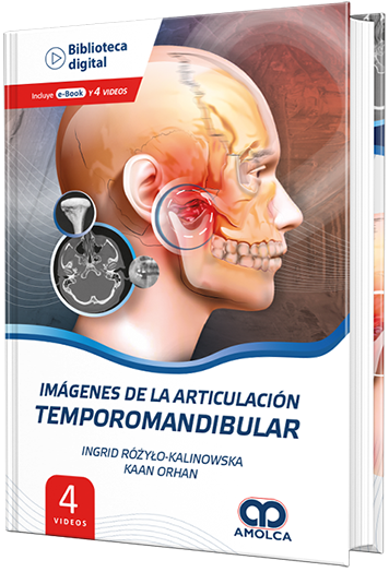 Imágenes de la Articulación Temporomandibular