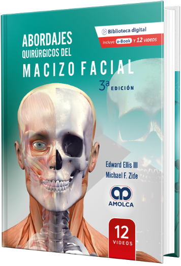 Abordajes Quirúrgicos del Macizo Facial. 3a Edición