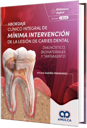Abordaje Clínico Integral de Mínima Intervención de la Lesión de Caries Dental