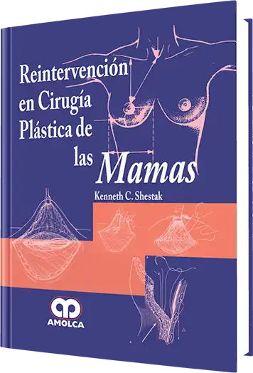 Reintervención en Cirugía Plástica de las Mamas