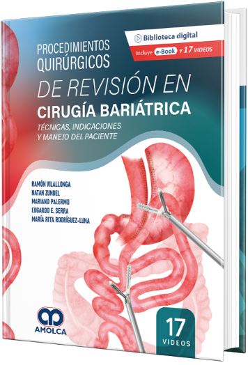 Procedimientos Quirúrgicos de Revisión en Cirugía Bariátrica. Técnicas, Indicaciones y Manejo del Paciente