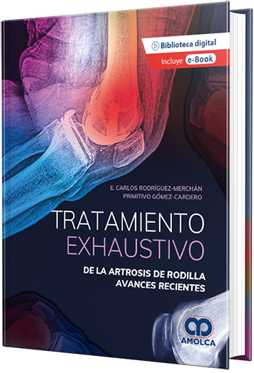 Tratamiento exhaustivo de la artrosis de rodilla