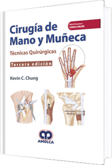 Cirugía de Mano y Muñeca 3 edición