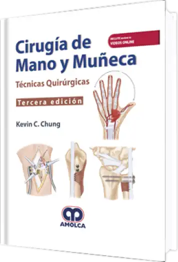 Cirugía de Mano y Muñeca 3 edición